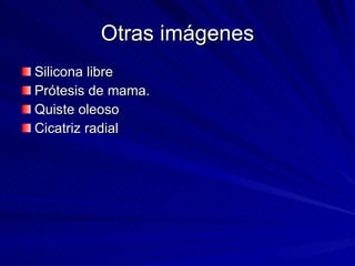 Otras imágenes Silicona libre Prótesis de mama. Quiste oleoso Cicatriz radial 