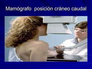 Mamógrafo  posición cráneo caudal 