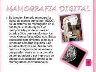    Es también llamada mamografía
    digital de campo completo (MDCC),
    es un sistema de mamografía en el
    que la película de rayos X es
    reemplazada por detectores en
    estado sólido que transforman los
    rayos X en señales eléctricas. Estos
    detectores son similares a los que
    tienen las cámaras digitales. Las
    señales eléctricas se utilizan para
    producir imágenes de las mamas
    que pueden verse en una pantalla
    de computadora o ser impresas en
    una película especial similar a los
    Mamogramas convencionales.
 