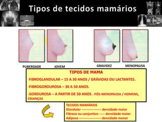PUBERDADE      JOVEM                       GRAVIDEZ            MENOPAUSA
                         TIPOS DE MAMA
  -FIBROGLANDULAR – 15 A 30 ANOS / GRÁVIDAS OU LACTANTES.
  -FIBROGORDUROSA – 30 A 50 ANOS.
  -GORDUROSA – A PARTIR DE 50 ANOS . PÓS-MENOPAUSA / HOMENS,
  CRIANÇAS
                       TECIDOS MAMÁRIOS
                       Glandular ------------------ densidade maior
                       Fibroso ou conjuntivo ----- densidade maior
                       Adiposo -------------------- densidade menor
 