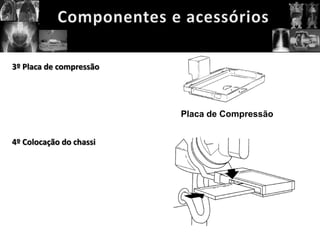 3º Placa de compressão




                         Placa de Compressão


4º Colocação do chassi
 
