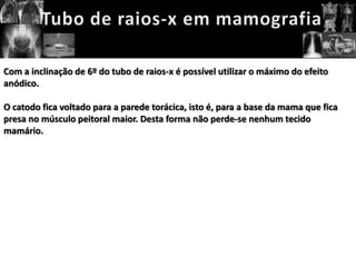 Com a inclinação de 6º do tubo de raios-x é possível utilizar o máximo do efeito
anódico.

O catodo fica voltado para a parede torácica, isto é, para a base da mama que fica
presa no músculo peitoral maior. Desta forma não perde-se nenhum tecido
mamário.
 