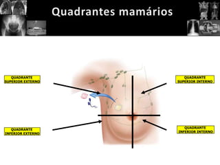 QUADRANTE          QUADRANTE
SUPERIOR EXTERNO   SUPERIOR INTERNO




                      QUADRANTE
   QUADRANTE
                   INFERIOR INTERNO
INFERIOR EXTERNO
 