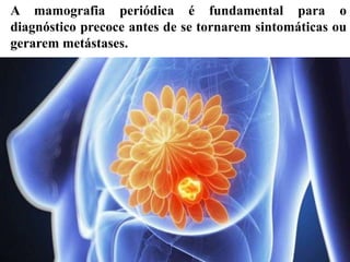 A mamografia periódica é fundamental para o
diagnóstico precoce antes de se tornarem sintomáticas ou
gerarem metástases.
 