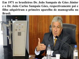 Em 1971 os brasileiros Dr. João Sampaio de Góes Júnior
e o Dr. João Carlos Sampaio Góes, respectivamente pai e
filho adquiriram o primeiro aparelho de mamografia no
Brasil.
 