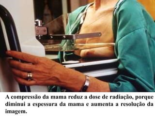 A compressão da mama reduz a dose de radiação, porque
diminui a espessura da mama e aumenta a resolução da
imagem.
 