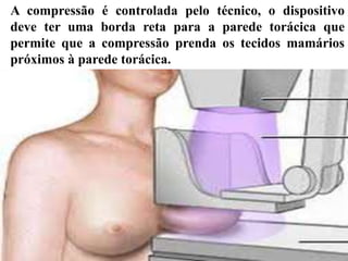 A compressão é controlada pelo técnico, o dispositivo
deve ter uma borda reta para a parede torácica que
permite que a compressão prenda os tecidos mamários
próximos à parede torácica.
 