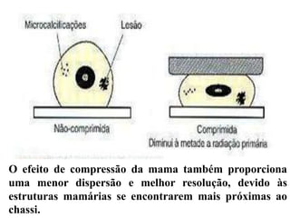 O efeito de compressão da mama também proporciona
uma menor dispersão e melhor resolução, devido às
estruturas mamárias se encontrarem mais próximas ao
chassi.
 
