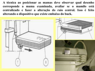 A técnica ao posicionar as mamas deve observar qual desenho
corresponde a mama examinada, avaliar se o mamilo está
centralizado e fazer a alteração do raio central. Isso é feito
alterando o dispositivo que existe embaixo do buck.
 