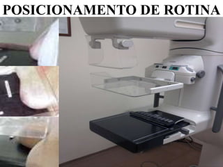 POSICIONAMENTO DE ROTINA
 
