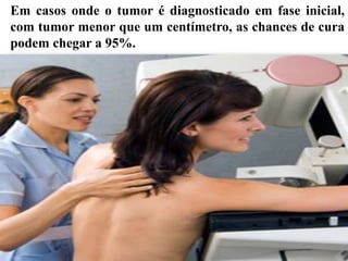 Em casos onde o tumor é diagnosticado em fase inicial,
com tumor menor que um centímetro, as chances de cura
podem chegar a 95%.
 
