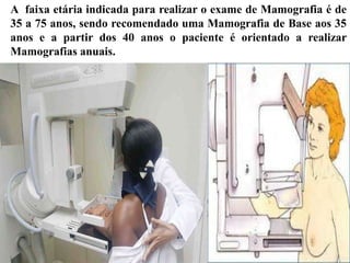 A faixa etária indicada para realizar o exame de Mamografia é de
35 a 75 anos, sendo recomendado uma Mamografia de Base aos 35
anos e a partir dos 40 anos o paciente é orientado a realizar
Mamografias anuais.
 