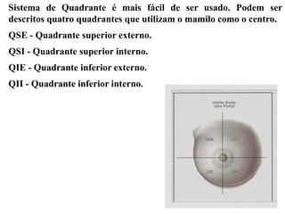 Sistema de Quadrante é mais fácil de ser usado. Podem ser
descritos quatro quadrantes que utilizam o mamilo como o centro.
QSE - Quadrante superior externo.
QSI - Quadrante superior interno.
QIE - Quadrante inferior externo.
QII - Quadrante inferior interno.
 