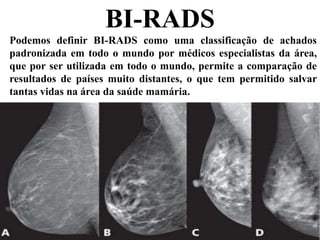 BI-RADS
Podemos definir BI-RADS como uma classificação de achados
padronizada em todo o mundo por médicos especialistas da área,
que por ser utilizada em todo o mundo, permite a comparação de
resultados de países muito distantes, o que tem permitido salvar
tantas vidas na área da saúde mamária.
 