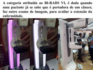A categoria atribuída ao BI-RADS VI, é dada quando
uma paciente já se sabe que é portadora de um câncer,
faz outro exame de imagem, para avaliar a extensão da
enfermidade.
 