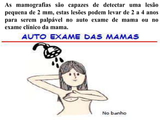 As mamografias são capazes de detectar uma lesão
pequena de 2 mm, estas lesões podem levar de 2 a 4 anos
para serem palpável no auto exame de mama ou no
exame clínico da mama.
 