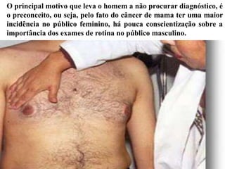 O principal motivo que leva o homem a não procurar diagnóstico, é
o preconceito, ou seja, pelo fato do câncer de mama ter uma maior
incidência no público feminino, há pouca conscientização sobre a
importância dos exames de rotina no público masculino.
 