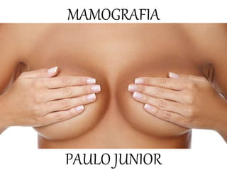 MAMOGRAFIA
PAULO JUNIOR
 