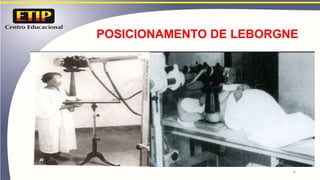 POSICIONAMENTO DE LEBORGNE
8
 