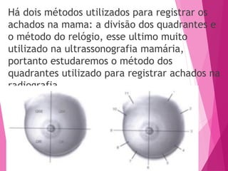 Há dois métodos utilizados para registrar os
achados na mama: a divisão dos quadrantes e
o método do relógio, esse ultimo muito
utilizado na ultrassonografia mamária,
portanto estudaremos o método dos
quadrantes utilizado para registrar achados na
radiografia.
 