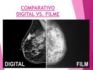 COMPARATIVO
DIGITAL VS. FILME
 