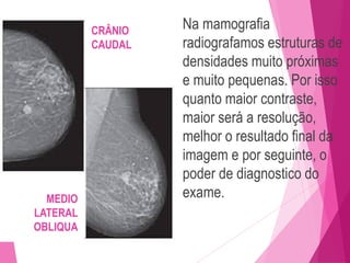 Na mamografia
radiografamos estruturas de
densidades muito próximas
e muito pequenas. Por isso
quanto maior contraste,
maior será a resolução,
melhor o resultado final da
imagem e por seguinte, o
poder de diagnostico do
exame.
MEDIO
LATERAL
OBLIQUA
CRÂNIO
CAUDAL
 