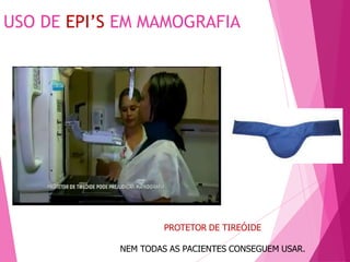 USO DE EPI’S EM MAMOGRAFIA
PROTETOR DE TIREÓIDE
NEM TODAS AS PACIENTES CONSEGUEM USAR.
 