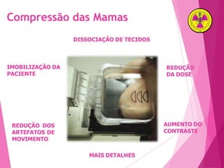 DISSOCIAÇÃO DE TECIDOS
AUMENTO DO
CONTRASTE
MAIS DETALHES
REDUÇÃO
DA DOSE
REDUÇÃO DOS
ARTEFATOS DE
MOVIMENTO
IMOBILIZAÇÃO DA
PACIENTE
Compressão das Mamas
 