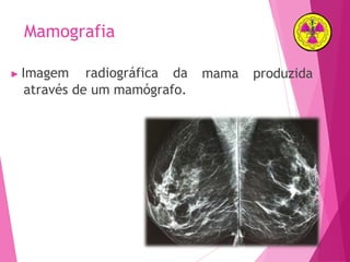 Mamografia
▶ Imagem radiográfica da
através de um mamógrafo.
mama produzida
 