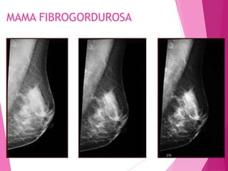 MAMA FIBROGORDUROSA
275
 
