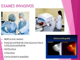 EXAMES INVASIVOS
▶ BIOPCIA DAS MAMAS
▶ PUNÇÃO ASPIRATIVA COM AGULHA FINA E
CITOLOGIAASPIRATIVA
▶ HISTOLOGIA
▶ CITOLOGIA
▶ CINTILOGRAFIA MAMÁRIA
 