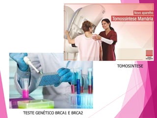 TESTE GENÉTICO BRCA1 E BRCA2
TOMOSINTESE
 