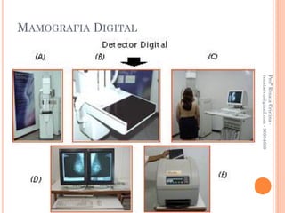 Profª Renata Cristina -
                     renatacvm@gmail.com - 96984689
MAMOGRAFIA DIGITAL
 