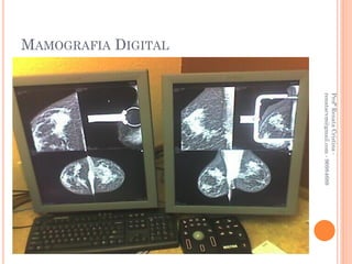 Profª Renata Cristina -
                     renatacvm@gmail.com - 96984689
MAMOGRAFIA DIGITAL
 