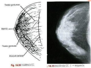 Profª Renata Cristina -
                   renatacvm@gmail.com - 96984689
ANATOMIA DA MAMA
 