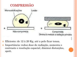 COMPRESSÃO




                                                          renatacvm@gmail.com - 96984689
                                                          Profª Renata Cristina -
   Eficiente: de 12 à 20 Kg, até a pele ficar tensa.
   Importância: reduz dose de radiação, aumenta o
    contraste e resolução espacial, diminui distorções,
    spott.
 