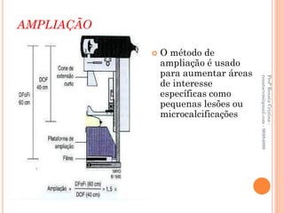 AMPLIAÇÃO

               O método de
                ampliação é usado
                para aumentar áreas




                                      renatacvm@gmail.com - 96984689
                                      Profª Renata Cristina -
                de interesse
                específicas como
                pequenas lesões ou
                microcalcificações
 