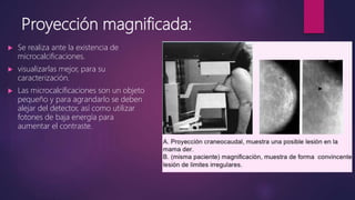 Proyección magnificada:
 Se realiza ante la existencia de
microcalcificaciones.
 visualizarlas mejor, para su
caracterización.
 Las microcalcificaciones son un objeto
pequeño y para agrandarlo se deben
alejar del detector, así como utilizar
fotones de baja energía para
aumentar el contraste.
 