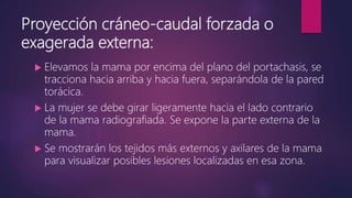 Proyección cráneo-caudal forzada o
exagerada externa:
 Elevamos la mama por encima del plano del portachasis, se
tracciona hacia arriba y hacia fuera, separándola de la pared
torácica.
 La mujer se debe girar ligeramente hacia el lado contrario
de la mama radiografiada. Se expone la parte externa de la
mama.
 Se mostrarán los tejidos más externos y axilares de la mama
para visualizar posibles lesiones localizadas en esa zona.
 
