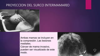 PROYECCION DEL SURCO INTERMAMARIO
 