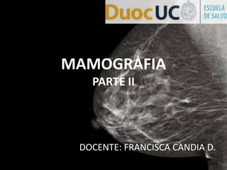 MAMOGRAFIA
PARTE II
DOCENTE: FRANCISCA CANDIA D.
 