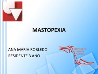MASTOPEXIA


ANA MARIA ROBLEDO
RESIDENTE 3 AÑO
 