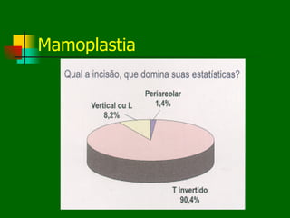 Mamoplastia
 
