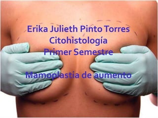 Erika Julieth Pinto Torres
      Citohistología
    Primer Semestre

Mamoplastia de aumento
 