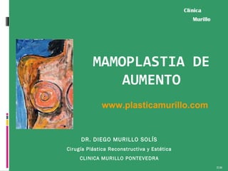Clínica
Murillo

MAMOPLASTIA DE
AUMENTO
www.plasticamurillo.com

DR. DIEGO MURILLO SOLÍS
Cirugía Plástica Reconstructiva y Estética
CLINICA MURILLO PONTEVEDRA
D.M.

 