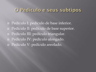  Pedículo I: pedículo de base inferior.
 Pedículo II: pedículo de base superior.
 Pedículo III: pedículo triangular.
 Pedículo IV: pedículo alongado.
 Pedículo V: pedículo areolado.
 