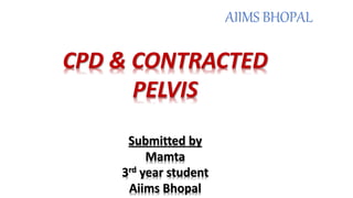 CPD & CONTRACTED
PELVIS
Submitted by
Mamta
3rd year student
Aiims Bhopal
AIIMS BHOPAL
 