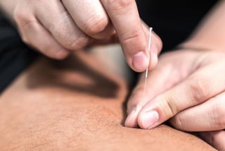 Risk in Acupuncture
