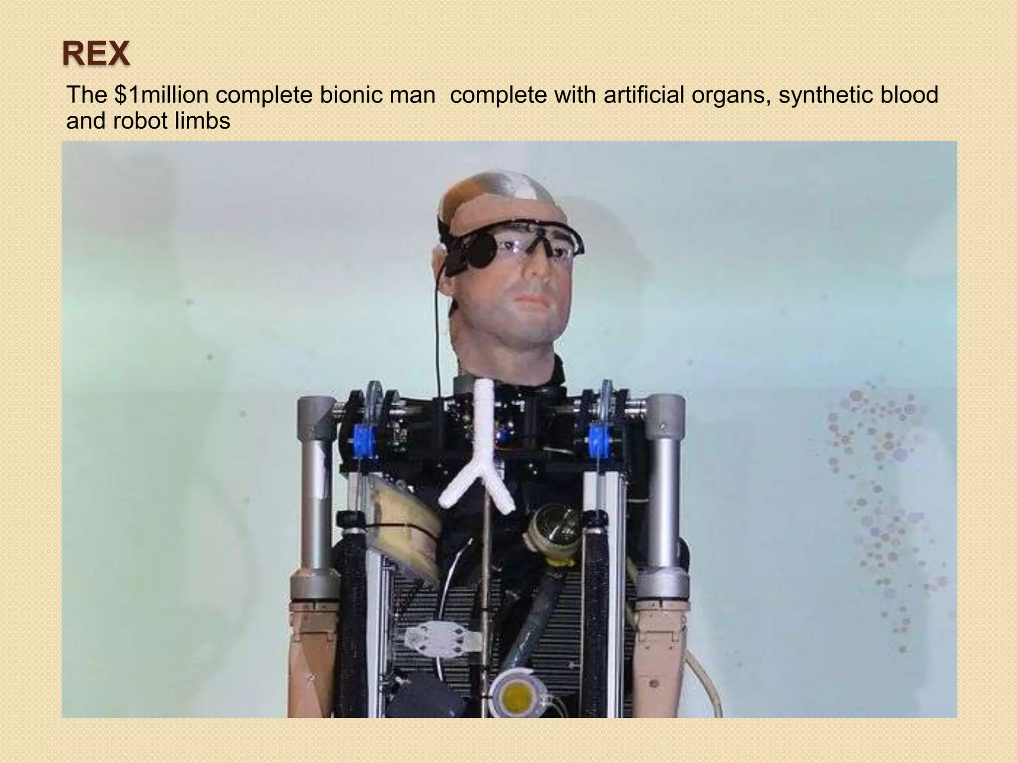 REX
The $1million complete bionic man complete with artificial organs, synthetic blood
and robot limbs
 