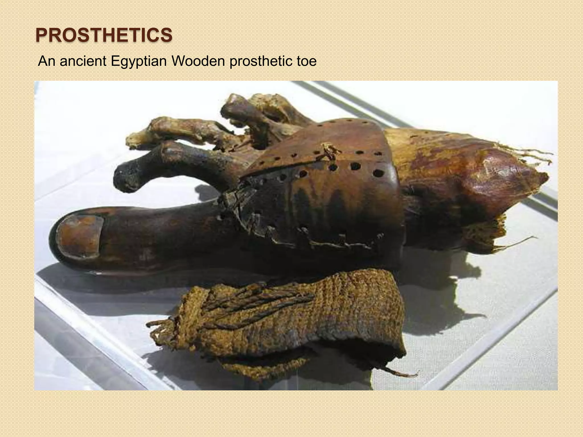 PROSTHETICS
An ancient Egyptian Wooden prosthetic toe
 
